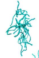 micrografia de planta spirogyra