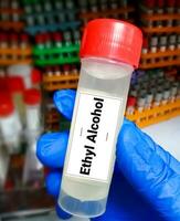 urina amostra para etilo álcool droga teste, álcool vício. foto