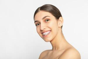 fechar acima retrato do sorridente adolescente menina mostrando dental aparelho ortodôntico. foto