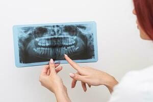 médico ortodontista análises a ortopantomograma do a pacientes mandíbulas para diagnosticar foto