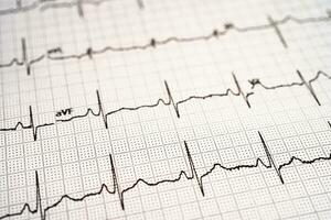 eletrocardiograma ecg, coração aceno, coração ataque, cardiograma relatório. foto