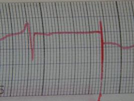 gráficos científicos, cardiogramas e cálculos matemáticos foto