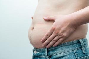 imagem da barriga obesa do homem, isolada no fundo branco foto