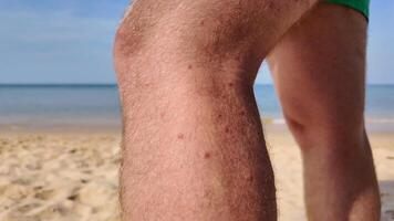 inseto mordidas em perna às praia, de praia mosca mordidas, de praia pulga mordidas foto