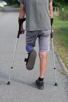 uma homem com uma quebrado perna é caminhando baixa a rua, em dele esquerda perna ele tem uma especial bota para caminhando foto