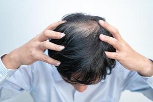 careca na cabeça do meio e começar sem perda de cabelo glabro de homem de escritório ativo inteligente de negócios asiáticos maduros. foto