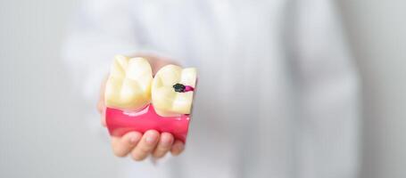 dentista com dente anatomia modelo. oral dentes decair e doença, raspar fora tártaro. marcha oral saúde, dentista dia, falso dentes. dor de dente e crianças dental saúde mês e ortodôntico saúde dia foto