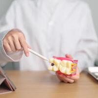 dentista com dente anatomia modelo. oral dentes decair e doença, raspar fora tártaro. marcha oral saúde, dentista dia, falso dentes. dor de dente e crianças dental saúde mês e ortodôntico saúde dia foto