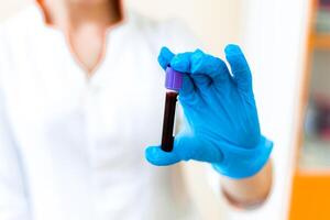 teste sangue amostra dentro a mão do uma fêmea técnico dentro a laboratório. mulher mão dentro protetora azul luva é segurando uma pequeno frasco do sangue em a borrado fundo. foto