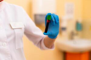 sangue amostra. laboratório técnico segurando sangue tubo amostra para estude foto