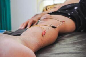 fechar-se agulhas em paciente corpo estimulado de elétrico. acupuntura, chinês alternativo remédio. foto
