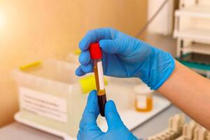 cientista trabalhando com sangue amostra dentro laboratório foto
