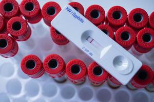 rápido teste cassete do hiv mostrando negativo teste resultado. acima a vermelho vácuo tubo foto