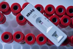 rápido teste cassete para hepatite b vírus teste hbsag em uma acima a vermelho aspirar tubo. mostra uma negativo resultado.copiar espaço foto