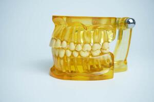 amarelo mandíbula modelo em branco fundo. dentaduras ou falso dentes foto