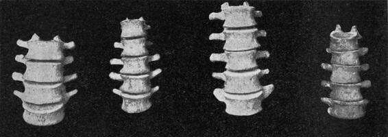 comparativo mesa do lombar vertebral colunas do uma europeu, a australiano, a africano negro e uma anão negro do a Filipinas, vintage gravação. foto