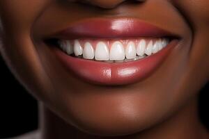 ai gerado fechar-se Preto mulher sorridente, lábios e limpar \ limpo branco até dentes. dentista anúncio, dental Cuidado e higiene conceito foto
