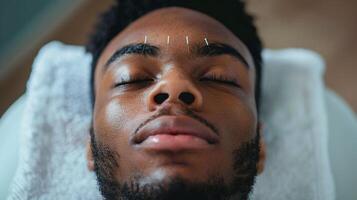 ai gerado uma homem recebendo acupuntura terapia face e massagem dentro clínica spa foto