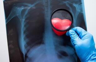 mão segurando ampliação vidro em x raio do uma humano peito. foto