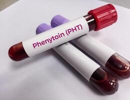 sangue amostra para fenitoína teste, terapêutico medicamento, para manter uma terapêutico nível e diagnosticar potencial para toxicidade foto