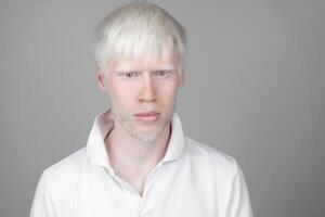 retrato do a albino homem dentro estúdio vestido camiseta isolado em uma branco fundo. anormal desvios. incomum aparência foto