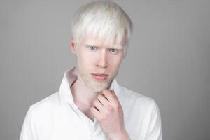 retrato do a albino homem dentro estúdio vestido camiseta isolado em uma branco fundo. anormal desvios. incomum aparência foto