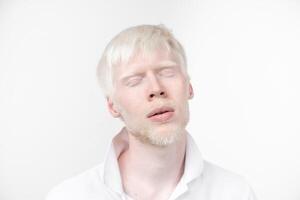 retrato do a albino homem dentro estúdio vestido camiseta isolado em uma branco fundo. anormal desvios. incomum aparência foto