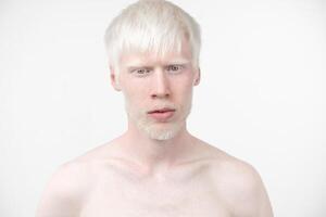 retrato do a albino homem dentro estúdio vestido camiseta isolado em uma branco fundo. anormal desvios. incomum aparência foto