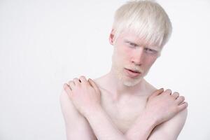 retrato do a albino homem dentro estúdio vestido camiseta isolado em uma branco fundo. anormal desvios. incomum aparência foto