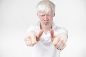 retrato do a albino homem dentro estúdio vestido camiseta isolado em uma branco fundo. anormal desvios. incomum aparência foto