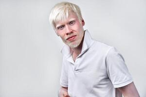 albinismo albino homem dentro estúdio vestido camiseta isolado em uma branco fundo. anormal desvios. incomum aparência foto