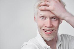 retrato do a albino homem dentro estúdio vestido camiseta isolado em uma branco fundo. anormal desvios. incomum aparência foto