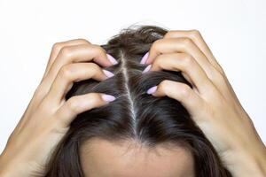 cortada tiro do uma jovem mulher coçar dela cabeça com dela dedos e unhas, isolado em uma branco fundo. couro cabeludo doenças fungo, caspa, irritação na pele, psoríase, seborréia. cabelo perda. coceira. fechar-se foto