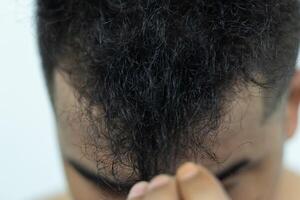 fechar acima jovem pessoas ter problemas com cabelo perda, secura, embotamento, Dividido termina e dano. foto