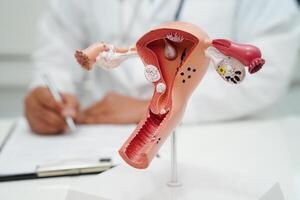 útero, médico segurando humano anatomia modelo para estude diagnóstico e tratamento dentro hospital. foto