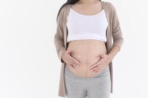 lindo grávida mulher aplicando hidratante, esticam marca creme em barriga, fertilidade infertilidade tratamento, fertilização in vitro, futuro maternidade conceito foto