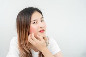 jovem mulher estão preocupado sobre rostos dermatologia e alérgico para esteróides dentro cosméticos. sensível pele, vermelho face a partir de queimadura de sol, acne, alérgico para produtos químicos, erupção cutânea em face. pele problemas e beleza foto