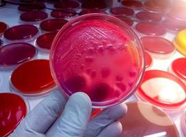 colônia de bactérias em placa de meio de cultura, e.coli foto