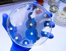 Teste de sensibilidade antimicrobiana em placa de Petri. resistência antibiótica de bactérias foto