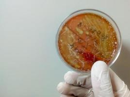 cientista ou médico segurando placa de Petri com colônia bacteriana. enterobacter spp. cultura de urina. vista de perto. foto