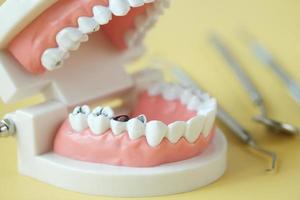 modelo de dentes dentários de plástico em fundo branco foto