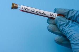mão segurando o teste de enzimas hepáticas in vitro sobre fundo azul. foto
