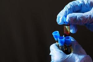 mão em luvas médicas azuis segurando o tubo de análise de sangue com espaço de cópia foto
