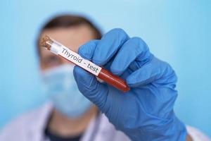 teste de tireóide a mão do médico segura um tubo de ensaio com sangue para o teste em luvas médicas em um fundo azul. foto