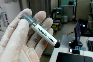 cientista segura um tubo de amostra de açúcar no sangue em jejum foto