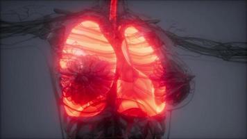 exame de radiologia de pulmões humanos foto