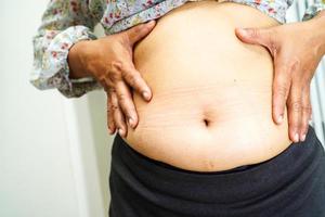 a mulher asiática com excesso de peso usa a mão para espremer a barriga gorda, o sobrepeso e a obesidade. foto