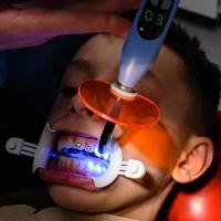 alinhamento de dentes tortos com a ajuda de aparelho, instalação de aparelho para uma criança, um ortodontista cola placas de metal aparelho para alinhamento dos dentes.
