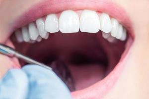 dentes femininos saudáveis foto