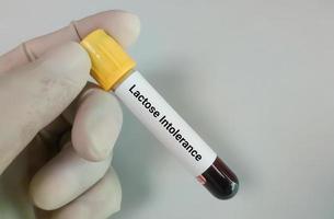amostra de sangue para teste de intolerância à lactose foto